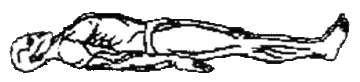   _2